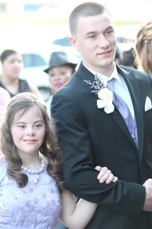 teen takes down syndrome to prom 