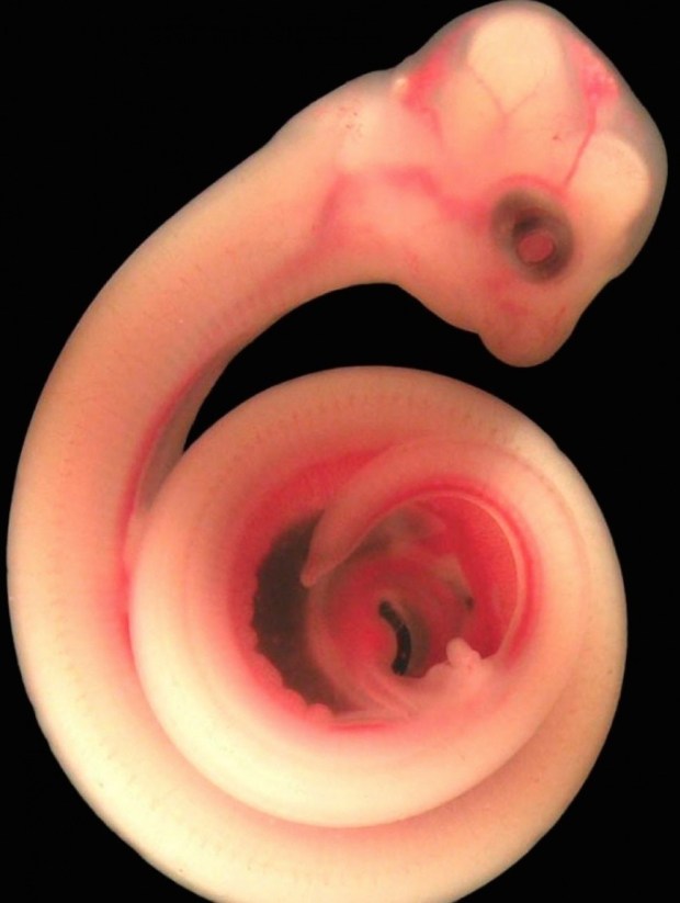 animals in womb 