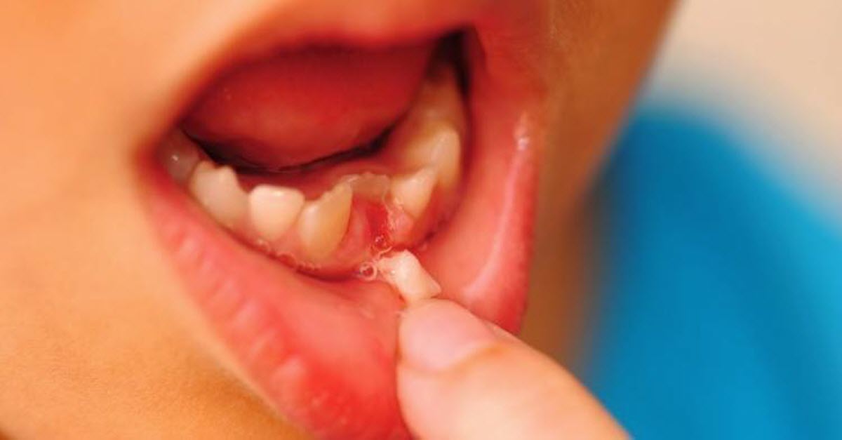 Keeping Your Child’s Baby Teeth May Save Their Life One Day And Here’s The Reason Why