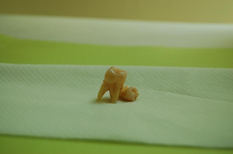 what to do with baby teeth 