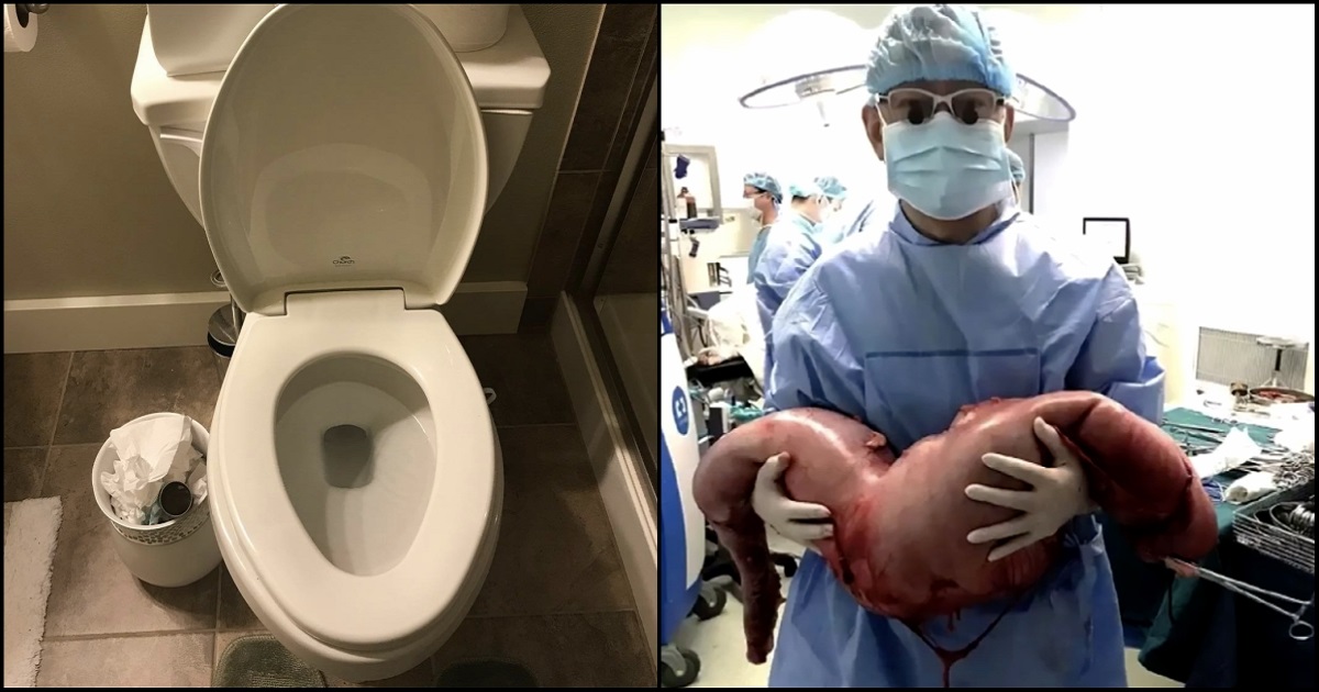 Man Feels Constipated For 22 Years Until Doctors Remove 30 Pounds Of Poop From His Body
