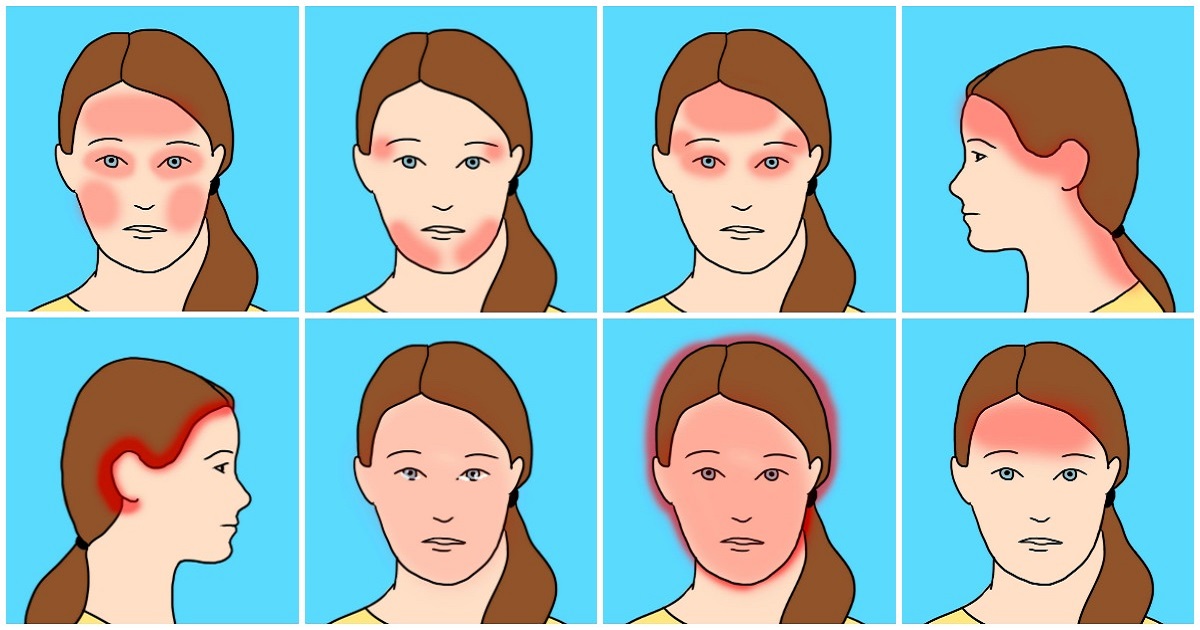 10 Common Headache Types And Their Surprising Causes