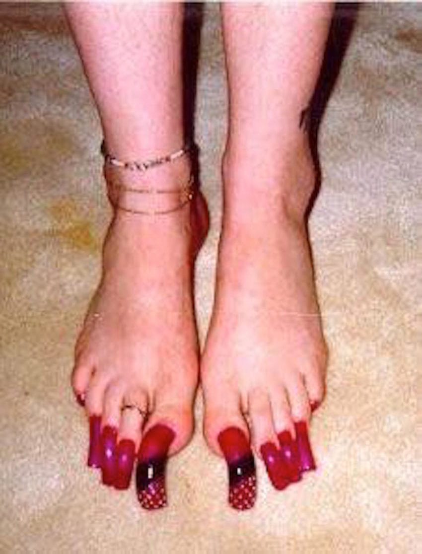 long toenails