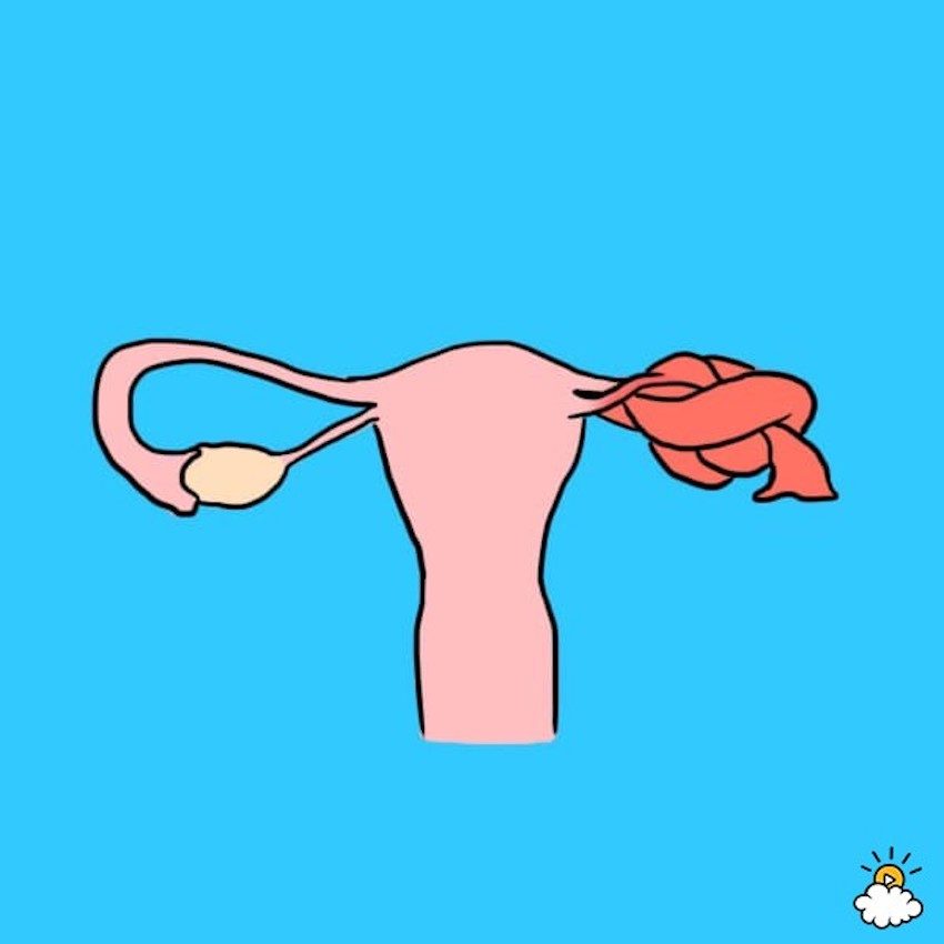 symptoms of ovarian cysts