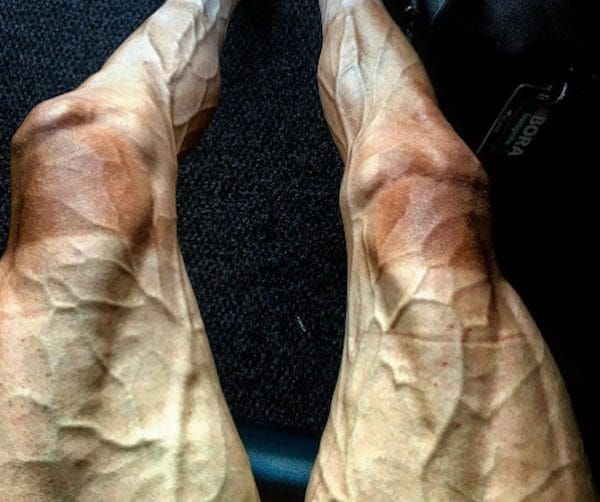27-Year-Old Cyclist Posts Photo Of His Legs After Biking 1,700 Miles In Tour De France