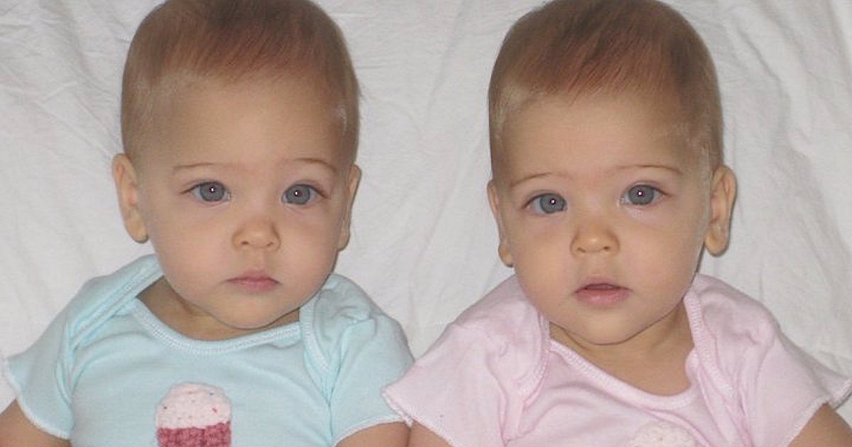 Identical Sisters Born In 2010 Have Grown Up To Become ‘Most Beautiful Twins In The World’