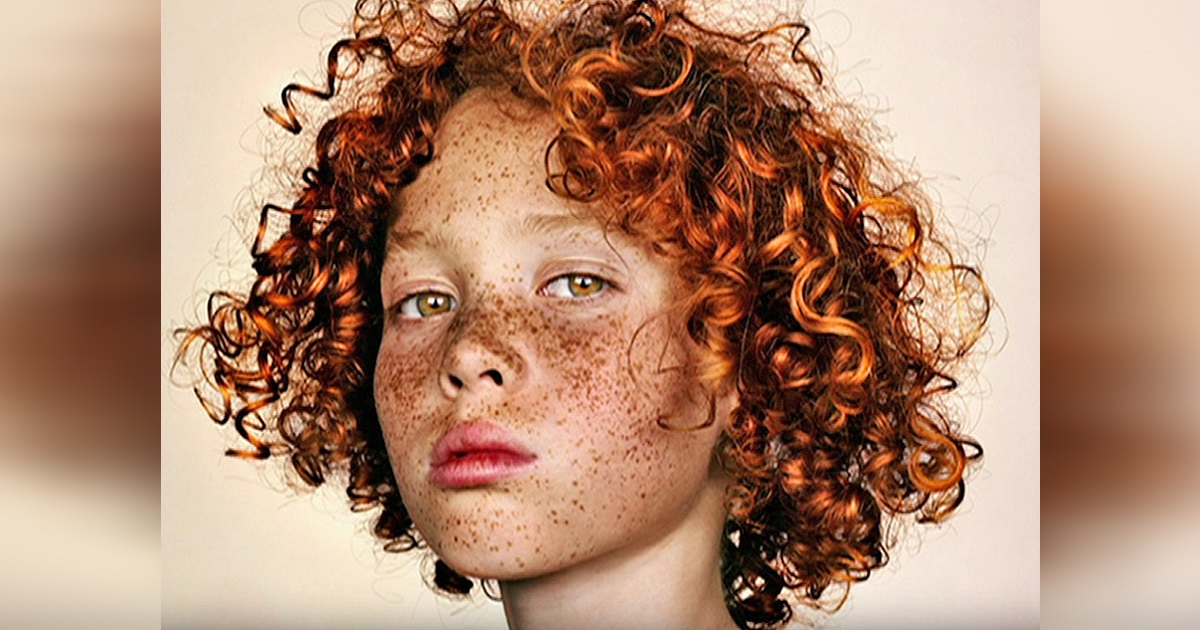 People Make Fun Of His Freckles, Then A Photographer Puts His Photo On Facebook To Show His Beauty