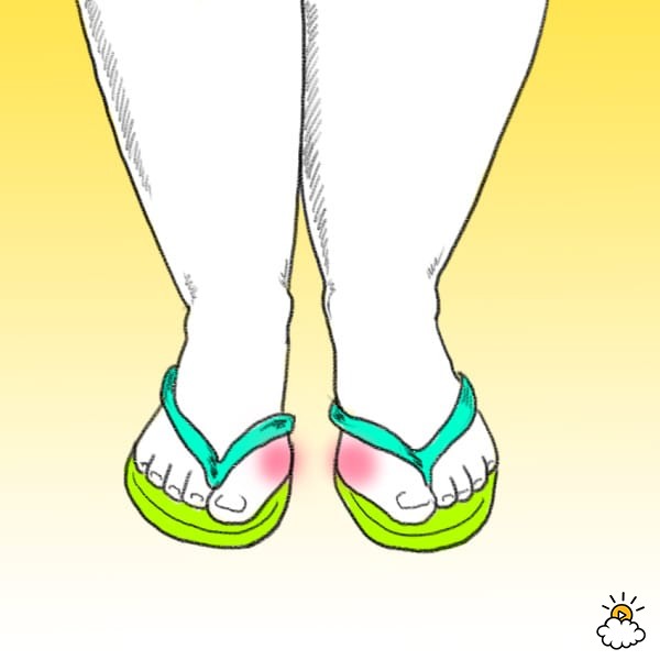 stop wearing flip flops