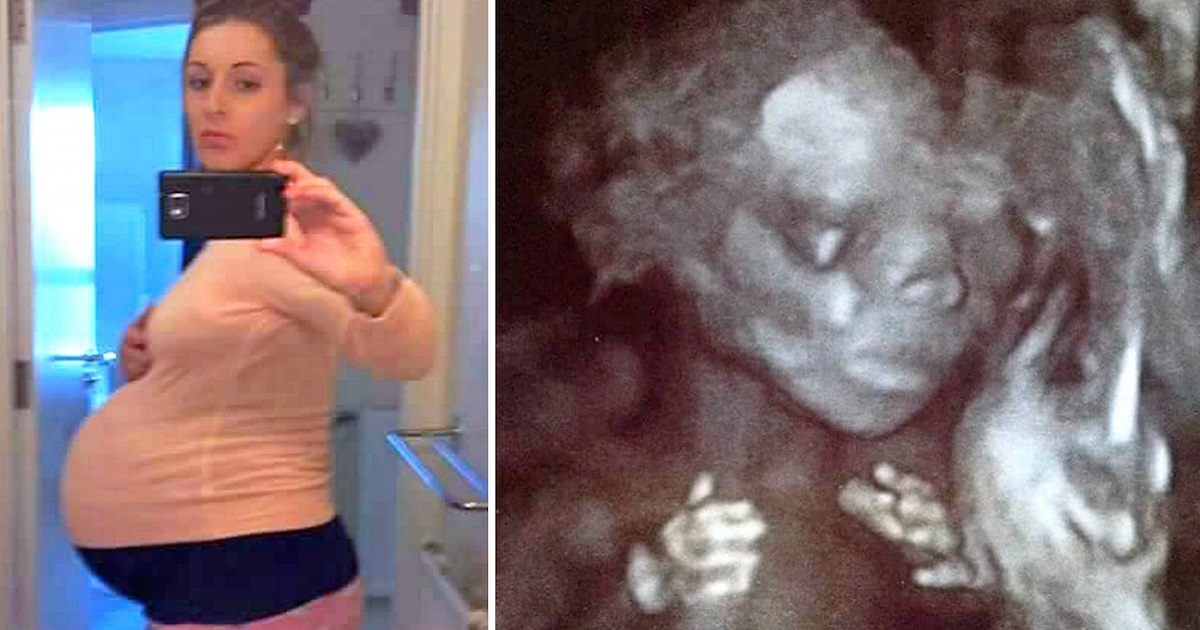 Young Surrogate Carries Baby For Couple But They Don’t Expect To See Extra 2 In Ultrasound