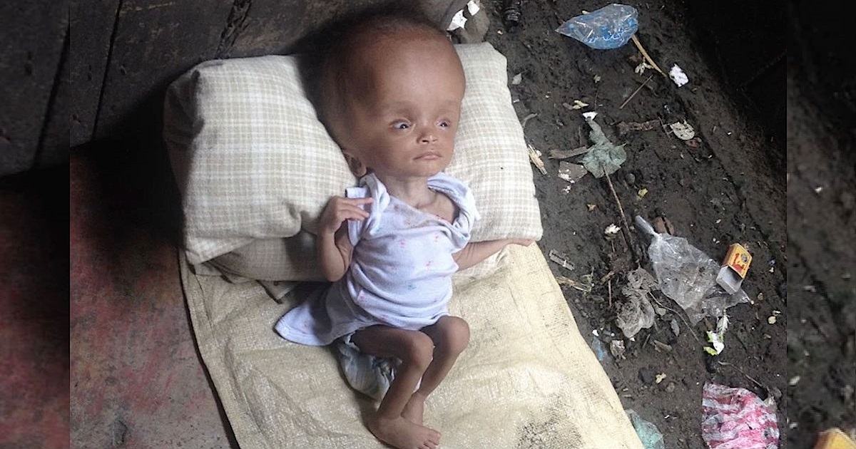 Hero Adopts Abandoned Infant On The Brink Of Death