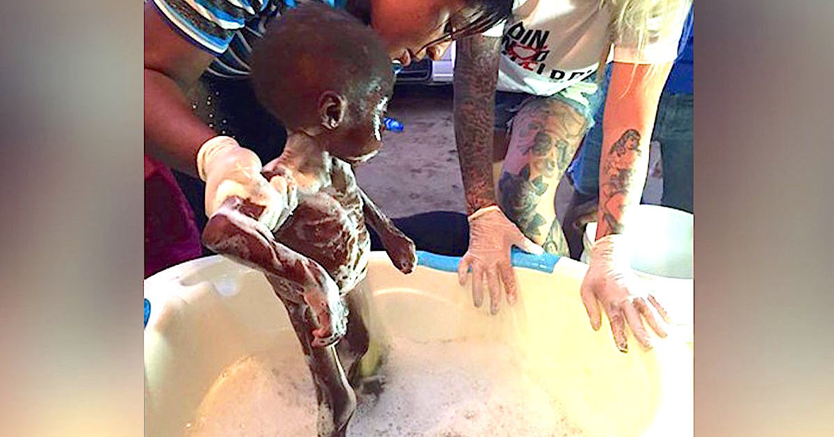 Starving 2-Year-Old Nigerian Boy Undergoes Incredible Transformation