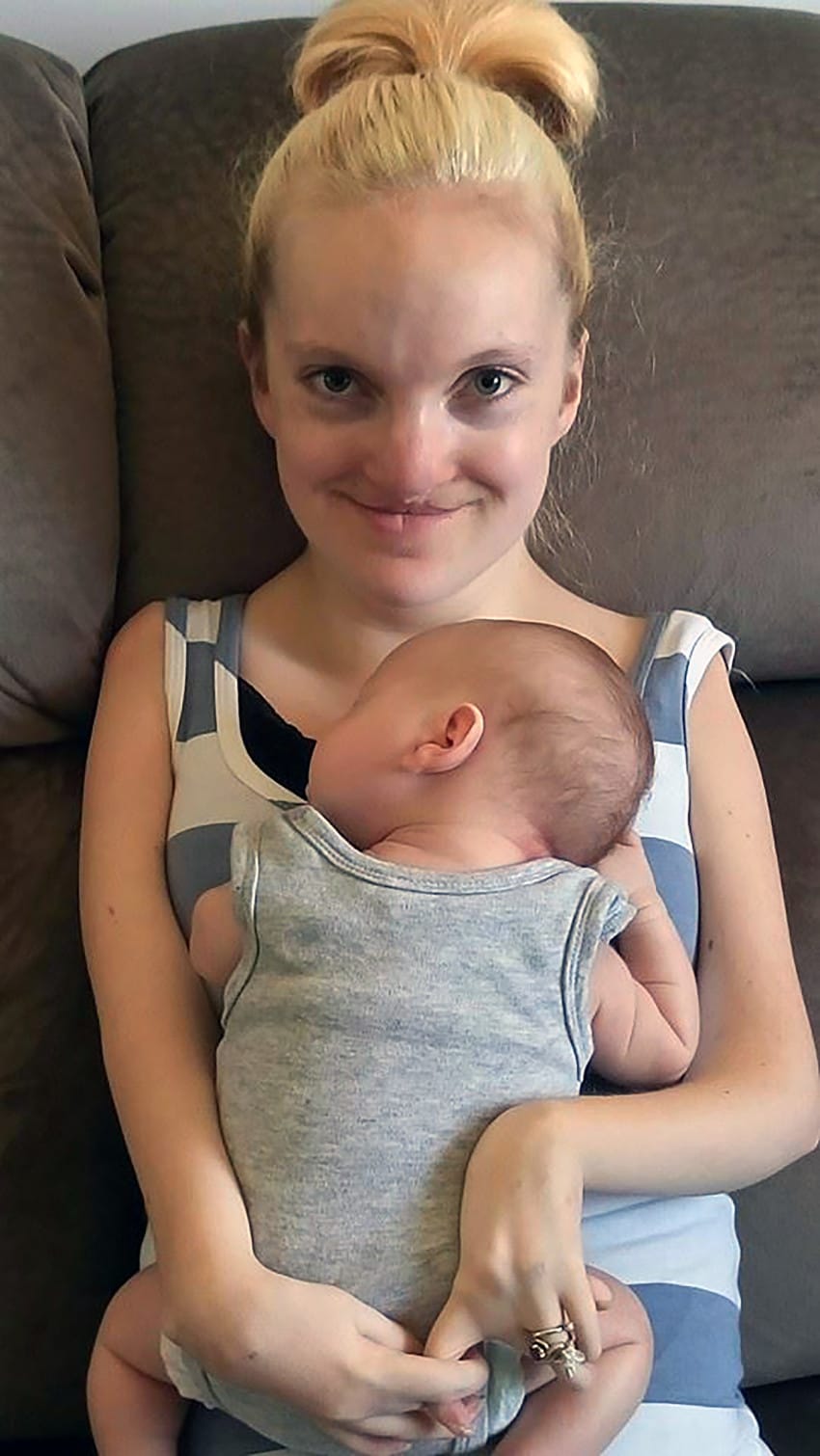 mom with rare muscle condition gives birth